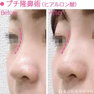 東京形成美容外科 船橋院 弓削田　浩主医師の症例