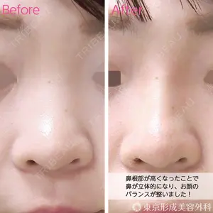 東京形成美容外科 船橋院 弓削田　浩主医師の症例