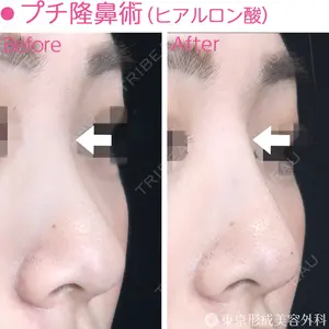 東京形成美容外科 船橋院 弓削田　浩主医師の症例