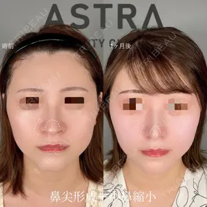 ASTRA BEAUTY CLINICの症例