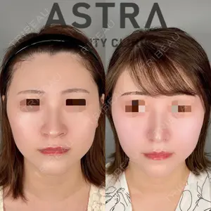 ASTRA BEAUTY CLINICの症例