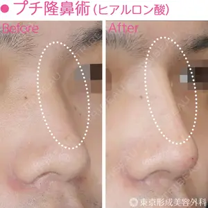 東京形成美容外科 船橋院 弓削田　浩主医師の症例
