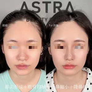 ASTRA BEAUTY CLINIC 塩満 惠子医師の症例