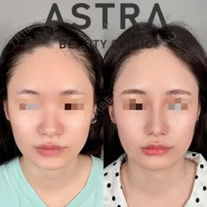 ASTRA BEAUTY CLINIC 塩満 惠子医師の症例