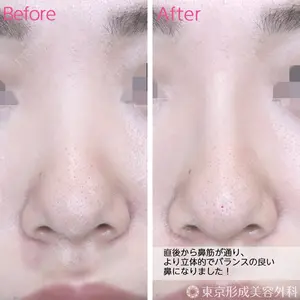 東京形成美容外科 船橋院 弓削田　浩主医師の症例