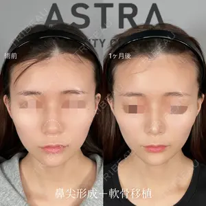 ASTRA BEAUTY CLINIC 塩満 惠子医師の症例