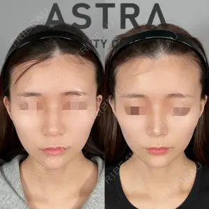 ASTRA BEAUTY CLINIC 塩満 惠子医師の症例