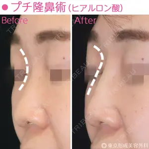東京形成美容外科 船橋院 山田 大輔医師の症例