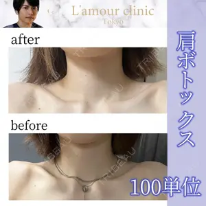 L‘amour clinic Tokyo【ラムールクリニック東京】 片岡 紘士医師の症例