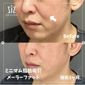 ziz CLINIC 村岡 史子医師の症例