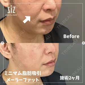 ziz CLINIC 村岡 史子医師の症例