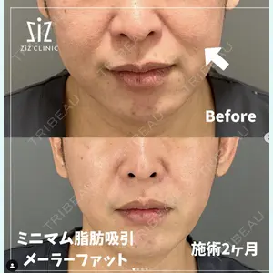 ziz CLINIC 村岡 史子医師の症例