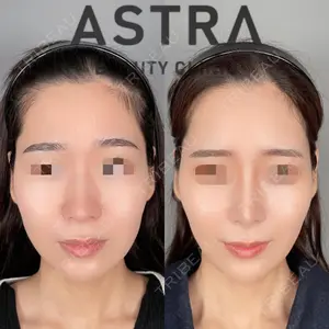 ASTRA BEAUTY CLINICの症例