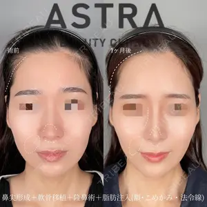 ASTRA BEAUTY CLINICの症例