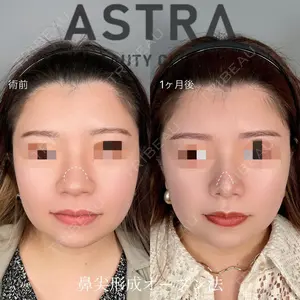 ASTRA BEAUTY CLINIC 塩満 惠子医師の症例