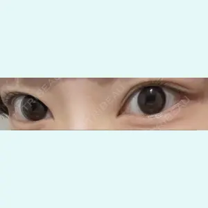 口コミ