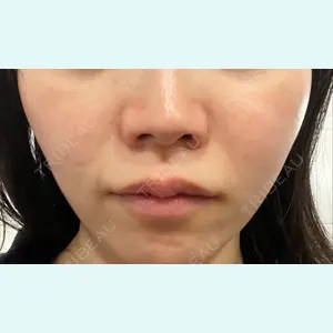 NEW FACE AESTHETIC CLINIC 新宿院口コミ