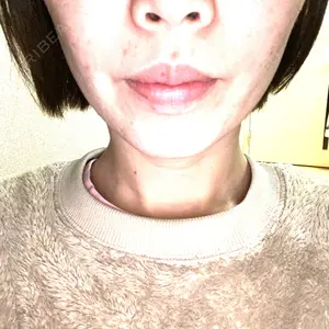 東京シンデレラ美容外科の口コミ