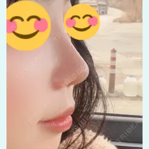 口コミ