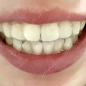 Shiny Teeth Clinic 【シャイニー ティース クリニック】の高橋 直人医師口コミ