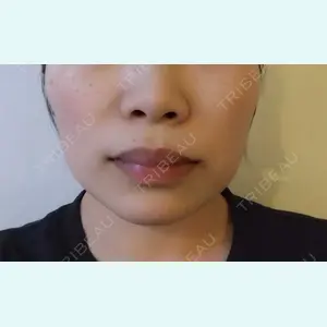 AI Beauty Clinic （エーアイ美容クリニック）口コミ