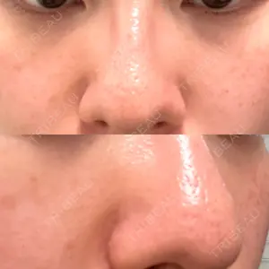 50 days after image
