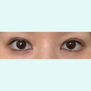 口コミ