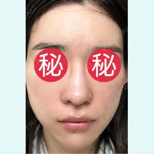 口コミ
