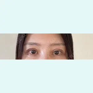 口コミ