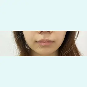 口コミ