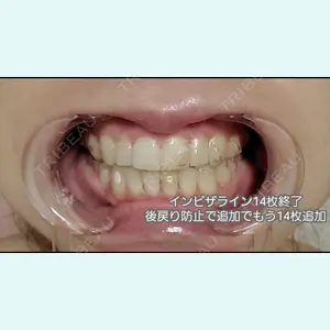 口コミ