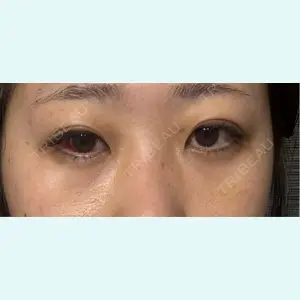 口コミ