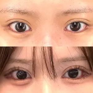 口コミ