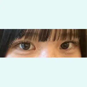 口コミ