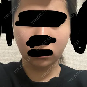 id（アイディ）美容外科のクォン・ジェヒョン医師口コミ