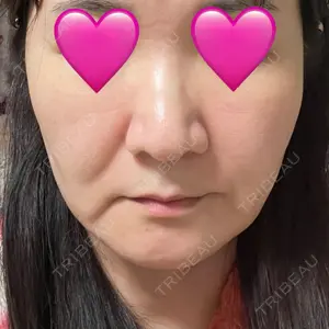 口コミ