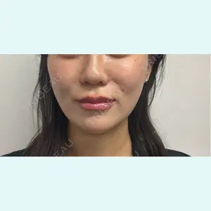 口コミ