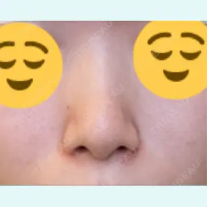 口コミ