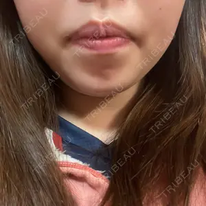 口コミ