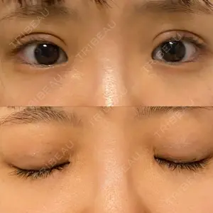 口コミ