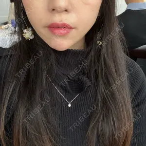 口コミ
