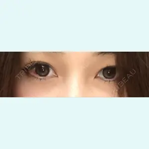 口コミ