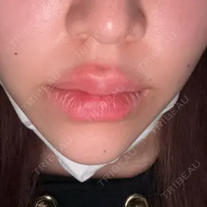 口コミ