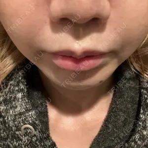 口コミ