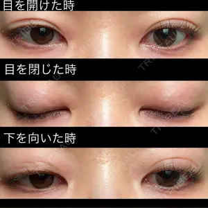 口コミ
