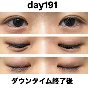 口コミ