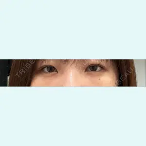 口コミ