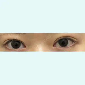 口コミ