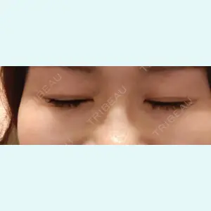 口コミ