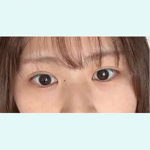 口コミ